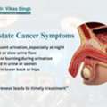 BPH Treatment Doctor Indore For Enlarged Prostate
