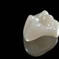 Restore Tooth Strength With Modern Crown Solutions