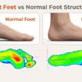 Custom Insoles Dubai | Insoles For Flat Feet In Dubai
