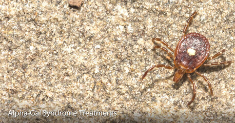 New York, Health, Expert Care For Targeted Alpha-Gal Treatment In NYC