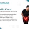 Best Bladder Cancer Doctor Indore For Safe Treatment