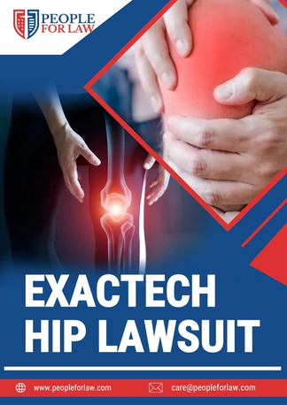 New York, Legal, Exactech Hip Lawsuit In Winter Park - People For Law