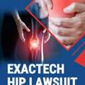 Exactech Hip Lawsuit In Winter Park - People For Law