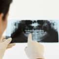 Anchorage Periodontal Treatment