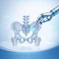 Superpath Hip Replacement Surgery In Pune