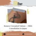 Remove Unwanted Tattoos &mdash; FREE Consultation In Jaipur