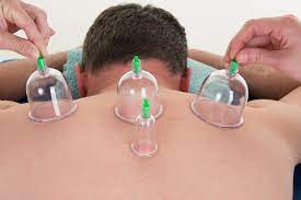 Riyadh, Creative, Hijama - The Best Treatment For Cleansing Your Body & Soul.