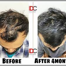 Riyadh, Creative, Hijama - The Best Treatment For Cleansing Your Body & Soul.