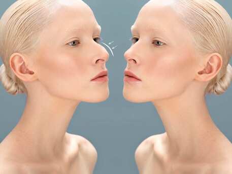 Cape Town, Health, Transform Your Look With Expert Nose Surgery In Cape Town