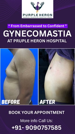 Jaipur, Health, Best Gynecomastia Surgeon In Jaipur - Dr. Nitesh Lamoria