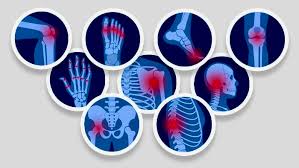 London, Health, Struggling With Long-Term Pain? How Chronic Pain Treatment Can Help &ndash; Marris Medical UK