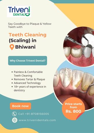 Haryana, Dental, Teeth Cleaning (Scaling) In Bhiwani | Triveni Dental