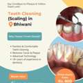 Teeth Cleaning (Scaling) In Bhiwani | Triveni Dental