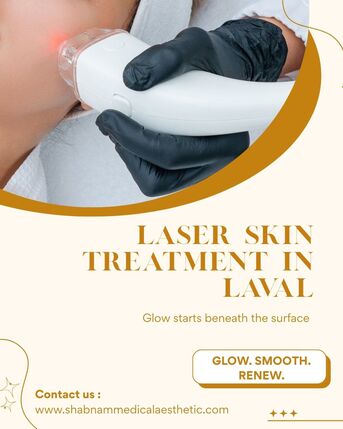 Toronto, Beautician, Why Choose Laser Skin Treatment Laval For Clear, Youthful Skin Today?
