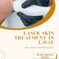 Why Choose Laser Skin Treatment Laval For Clear, Youthful Skin Today?