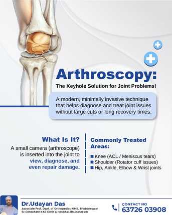 Bhubaneswar, Health, Arthroscopy | Orthopaedic Surgeon In Bhubaneswar | Dr Udayan Das.