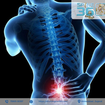 Ahmedabad, Health, Get Expert Spine Care From Best Spine Surgeon In Ahmedabad - Dr. Rohit Thaker