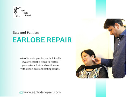 Chennai, Health, Safe Cheap Baby Piercing & Ear Closure Experts Chennai