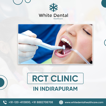 Ghaziabad, Dental, Best RCT Clinic In Indirapuram