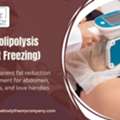Best Cryolipolysis Weight Loss Treatment For Body Contouring