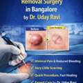 Advanced Care For Safe Sebaceous Cyst Removal - Dr. Uday Ravi