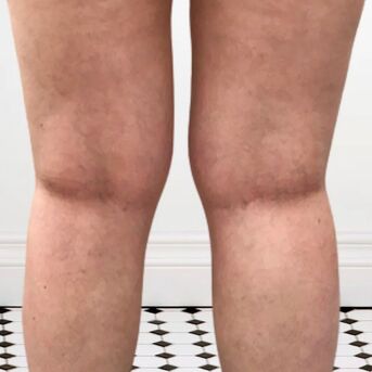 Toronto, Business, Leg Vein Health Supplements For Better Circulation Support