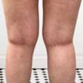 Leg Vein Health Supplements For Better Circulation Support