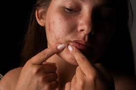 New York, Health, Break The Oil-Clog Cycle With A Gentle Daily Cleanse