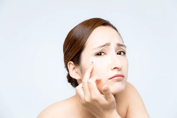 New York, Health, Target Excess Oil And Visible Pores With One Lightweight Step