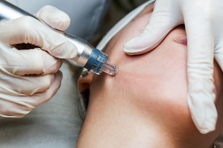 Bangalore, Health, Best Hydrafacial Clinic In Bangalore &ndash; Instant Glow Awaits! ✨