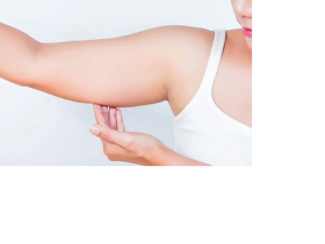 Ahmedabad, Business, Arm & Thigh Lift Treatment In Ahmedabad With Advanced Face Lift Solutions