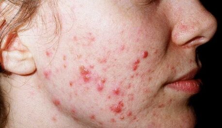 New York, Health, Gentle Daily Cleanser For Clearer Looking Skin