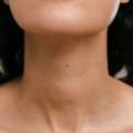 Neck Lift Surgery For A Defined, Youthful Neckline