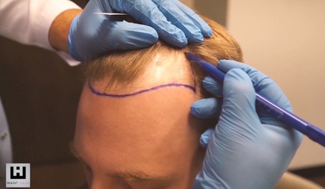 Istanbul, Beautician, Best Hair Transplant Turkey - Affordable & Natural Results