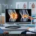 Before And After Knee Replacement Surgery | Dr. Rahul Grover