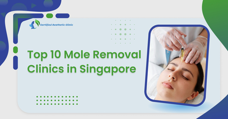 Singapore, Health, Mole Removal Singapore: Top Doctors Listed