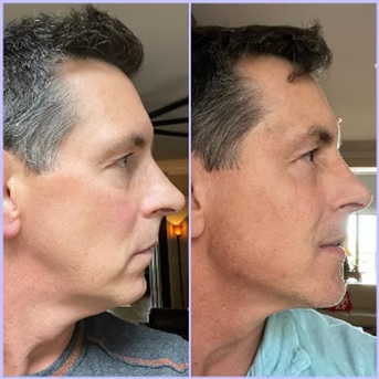 Miami, Business, Randy Lindgren Aesthetic Rejuvenation