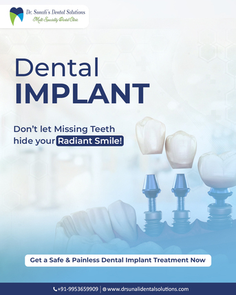 Noida, Dental, Dental Implants In Noida | Best Implant Dentist | Permanent Tooth Replacement