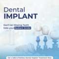 Dental Implants In Noida | Best Implant Dentist | Permanent Tooth Replacement