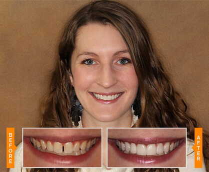 Dublin, Dental, Trusted Columbus Dentist For Complete Dental Care - Dublin Metro Dental