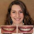 Trusted Columbus Dentist For Complete Dental Care - Dublin Metro Dental