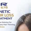 Advanced Genetic Hair Loss Treatment At QR678 India
