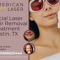 Facial Laser Hair Removal Austin, TX &ndash; Safe & Gentle Hair Removal | Book Today