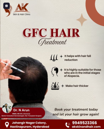 Hyderabad, Health, Trusted Hair Restoration Experts For Natural Results In Hyderabad
