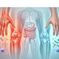 Rheumatoid Arthritis Isn&rsquo;t Just Joint Pain: Discover The Hidden Driver Most Doctors Miss