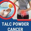 Talc Powder Cancer In Winter Park - People For Law