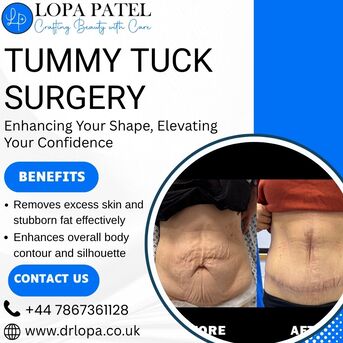 London, Health, Tummy Tuck Surgery In UK