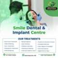 Best Dental Hospital Near Secunderabad: Smile Dental And Implant Centre