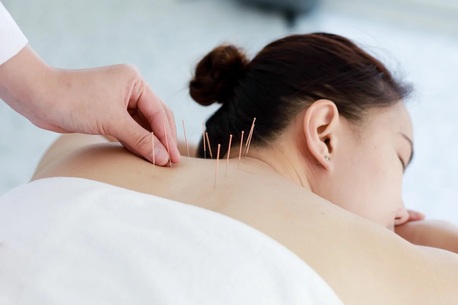 London, Health, Professional Acupuncture Treatment London Restore Balance Relieve Pain Naturally
