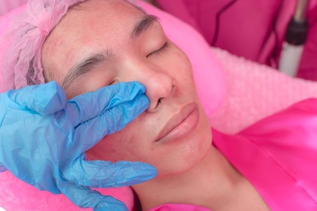 Dubai, Beautician, Effective Double Chin Treatment & Skin Tightening Solutions In Dubai